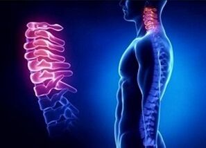 The reasons for the development of cervical osteochondrosis