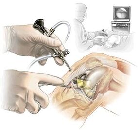 Clarification of the diagnosis of dash medicine osteoarthritis