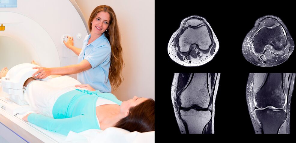 knee joint diagnosis