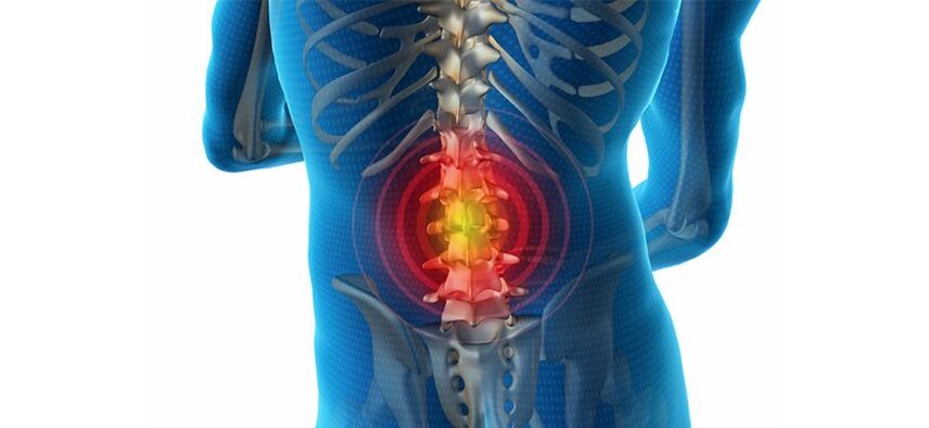 methods to diagnose back pain